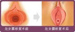 做膜前需要注意什么事项