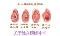 膜的时间是什么时候